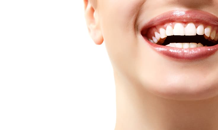 Teeth Whitening in Bristol