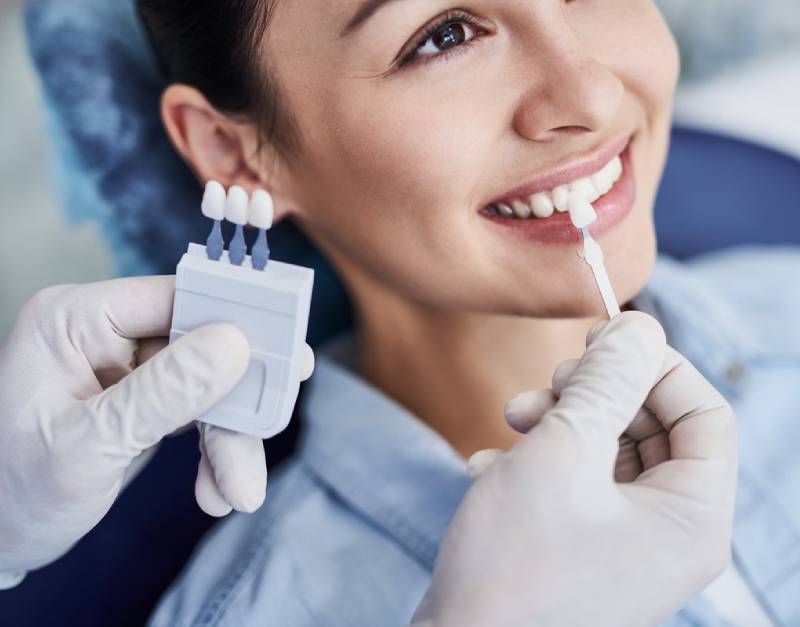 composite-bonding-shade-matching-bristol (2) Composite bonding shade matching Bristol – Dental Touch