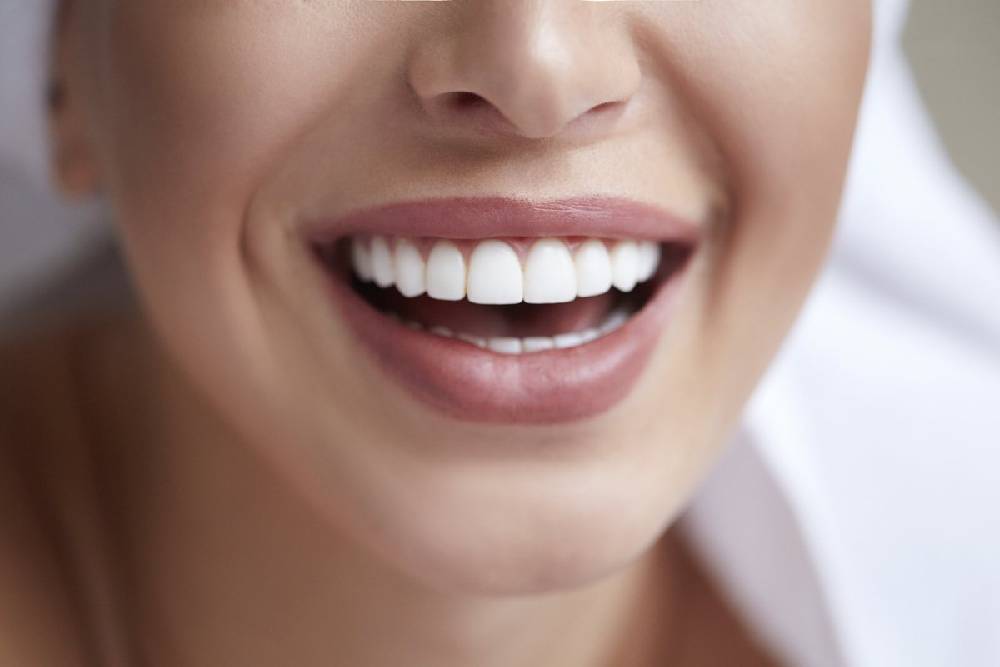Cosmetic teeth whitening Bristol – Dental Touch