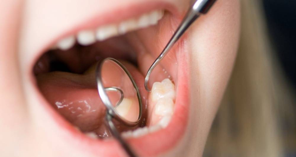 tooth-extraction-bristol Tooth extraction Bristol – Dental Touch